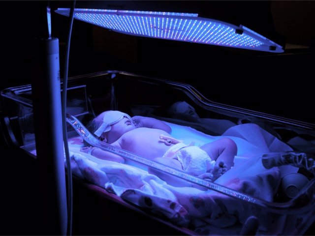 La luz azul en recién nacidos es un tratamiento habitual para eliminar el exceso de bilirrubina en bebés.